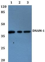 CD226 Antibody in Western Blot (WB)