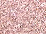 delta Catenin Polyclonal Antibody