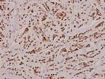 Caspase 2 Polyclonal Antibody