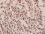GNAZ Polyclonal Antibody