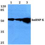 hnRNP K Polyclonal Antibody