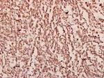 ZEB2 Polyclonal Antibody