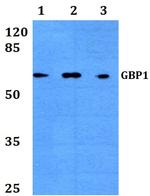 GBP1 Polyclonal Antibody