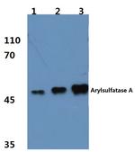 Arylsulfatase A Polyclonal Antibody