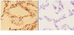 Aldolase B Polyclonal Antibody