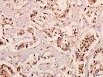 NDUFB10 Polyclonal Antibody