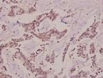 PKC theta Polyclonal Antibody