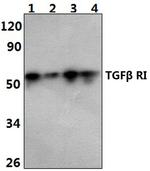TGFBR1 Antibody in Western Blot (WB)