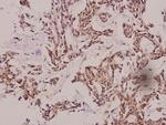 Cathepsin E Polyclonal Antibody