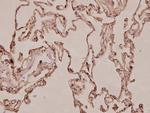 S100A10 Antibody in Immunohistochemistry (Paraffin) (IHC (P))