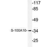 S100A10 Antibody in Western Blot (WB)