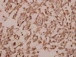 Cytokeratin 13 Polyclonal Antibody