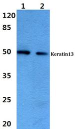 Cytokeratin 13 Antibody in Western Blot (WB)