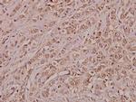 Annexin A3 Polyclonal Antibody
