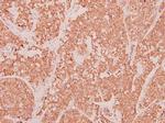 CCL3 Polyclonal Antibody