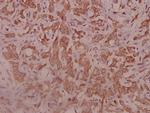 IL5RA Polyclonal Antibody