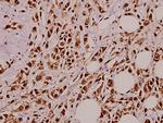 NGF Polyclonal Antibody