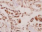 VASP Polyclonal Antibody