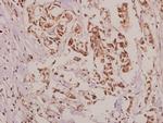 VASP Polyclonal Antibody