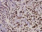 Zap-70 Antibody in Immunohistochemistry (Paraffin) (IHC (P))