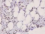 Stathmin 1 Polyclonal Antibody