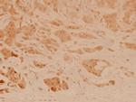 Stathmin 1 Polyclonal Antibody