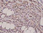 Cortactin Antibody in Immunohistochemistry (Paraffin) (IHC (P))