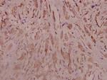 TrkB Polyclonal Antibody