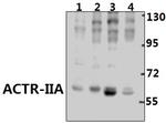 ACVR2A Polyclonal Antibody
