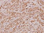 Cathepsin D Polyclonal Antibody
