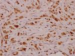 VEGFD Polyclonal Antibody