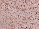 Haptoglobin Polyclonal Antibody