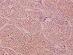 IL-16 Polyclonal Antibody