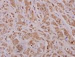 MMP12 Polyclonal Antibody