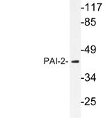 SERPINB2 Antibody in Western Blot (WB)