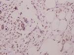 RAD51 Polyclonal Antibody