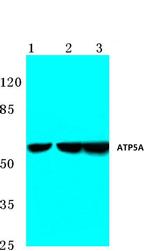 ATP5A1 Antibody in Western Blot (WB)