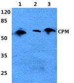 Carboxypeptidase M Antibody in Western Blot (WB)