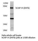 NCAPH Polyclonal Antibody