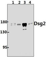 Desmoglein 2 Polyclonal Antibody