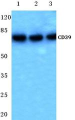 CD39 Antibody in Western Blot (WB)