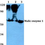 ME1 Polyclonal Antibody
