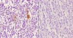 Phospho-Vimentin (Ser56) Antibody in Immunohistochemistry (Paraffin) (IHC (P))