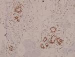 Phospho-ATM (Ser1981) Antibody in Immunohistochemistry (Paraffin) (IHC (P))