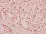 ATM Antibody in Immunohistochemistry (Paraffin) (IHC (P))