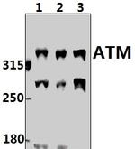 ATM Antibody in Western Blot (WB)