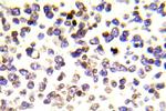 Histone H2A.X Antibody in Immunohistochemistry (Paraffin) (IHC (P))