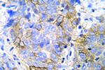 JAK1 Polyclonal Antibody