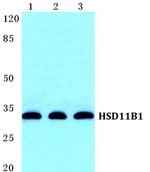 HSD11B1 Polyclonal Antibody