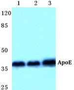 APOE Polyclonal Antibody